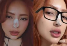 Influenciadora Ruivinha de Marte “arruma” nariz e revela novos procedimentos