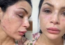 Musa de escola de samba é agredida em emboscada durante corrida por aplicativo em Manaus