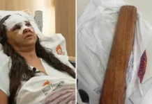 Mulher em tratamento contra câncer é atacada a pauladas pelo companheiro