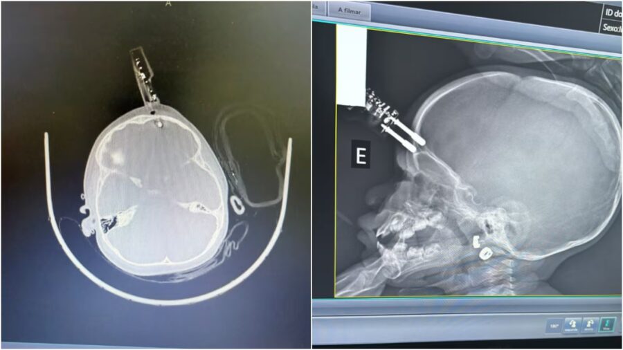 FKHFGEGJQRDXTGC2YAUH5RNNJA