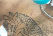 Hospital João Lúcio pede ajuda para identificar paciente em estado gravíssimo com tatuagens