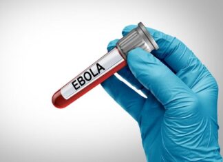 Ebola, novo caso suspeito de brasileira vinda do Congo está sendo investigado