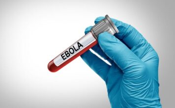 Ebola, novo caso suspeito de brasileira vinda do Congo está sendo investigado