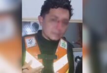 Mototaxista fica ferido após linha de papagaio cortar seu rosto em município do Amazonas